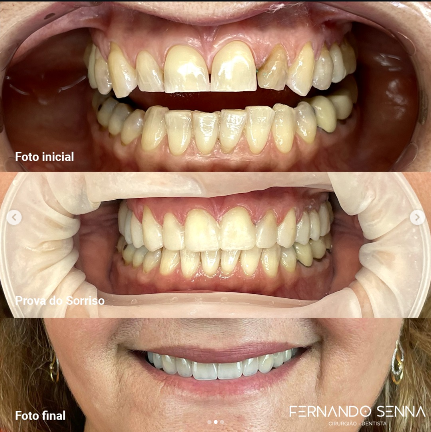 1 ESTÉTICA DENTAL - 3 em 1