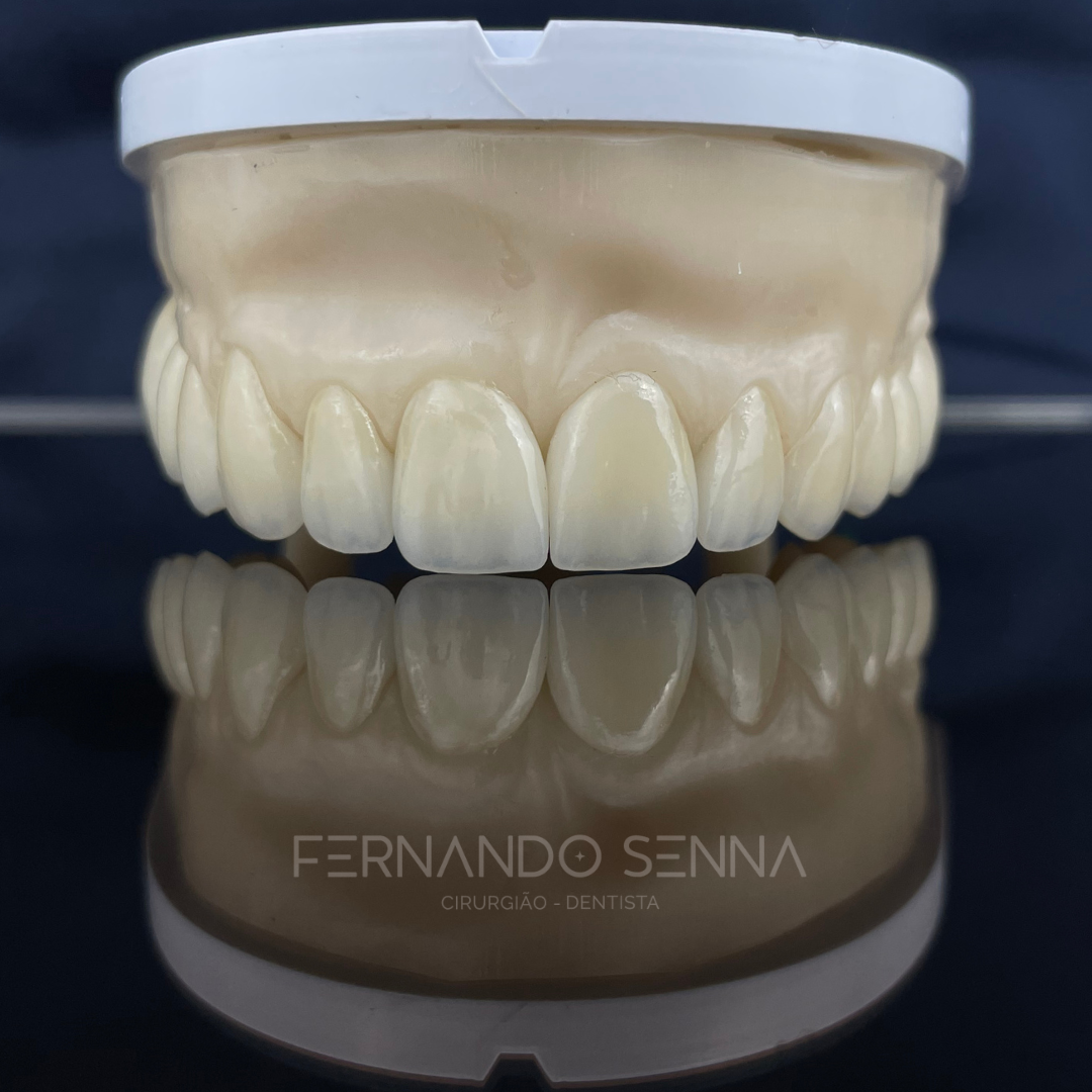 1 ESTÉTICA DENTAL - MODELO