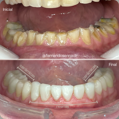 REABILITAÇÃO AVANÇADA